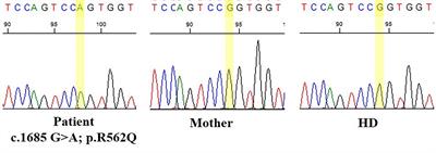 Research-based flow cytometry assays for pathogenic assessment in the human B-cell biology of gene variants revealed in the diagnosis of inborn errors of immunity: a Bruton’s tyrosine kinase case-study